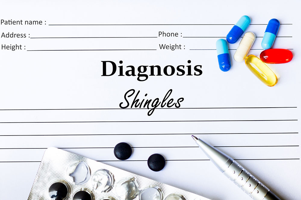 Shingles – Symptoms, Risk Factors, and Treatments