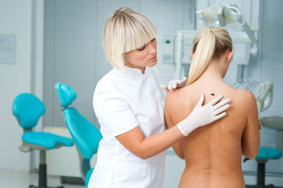 You Probably Didn’t Know That Melanoma Symptoms Can Appear Inside This Delicate Body Part